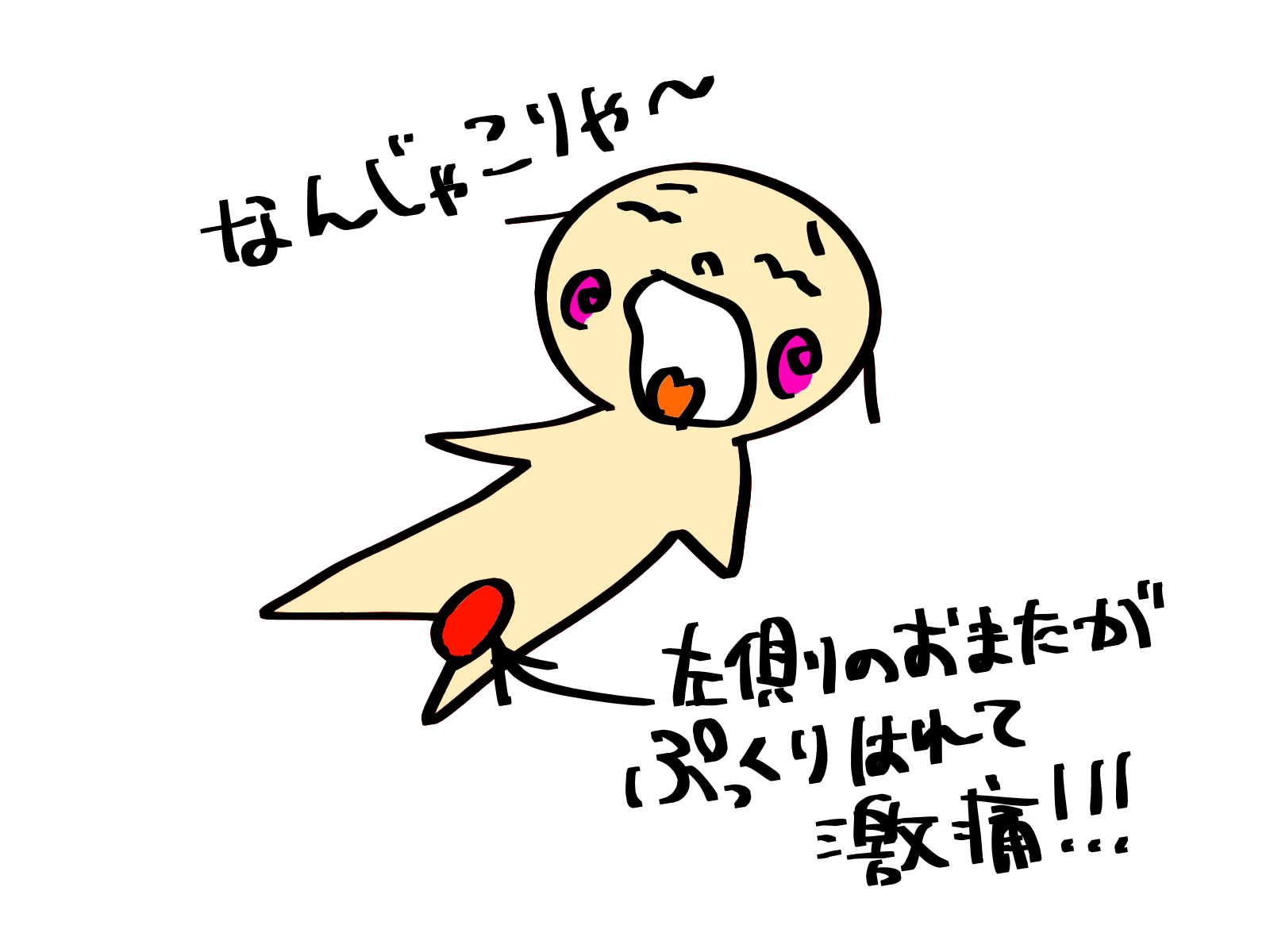 分娩時外陰部血腫になった！血腫とはなんぞや！